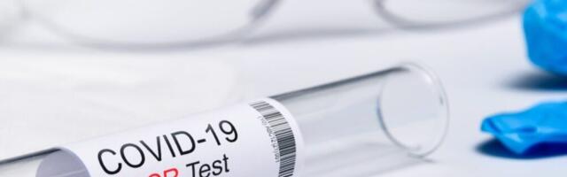 Hiljutine Saksamaa uuring näitab: PCR-test on paljastatud poliitilise pettusena