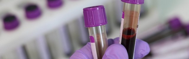 Synlab oskab nüüd verest senisest täpsemalt COVID-19 antikehi määrata