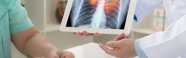 Uus biomarker võib ennustada vähipatsiendi reaktsiooni immuunravile