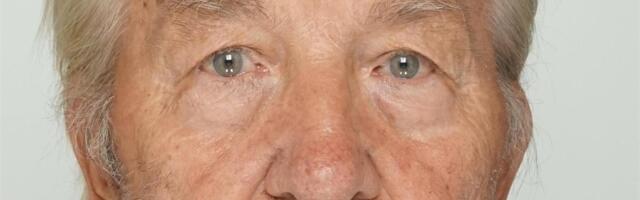 Politsei otsib Kastre vallas kadunud 85-aastast Heinut