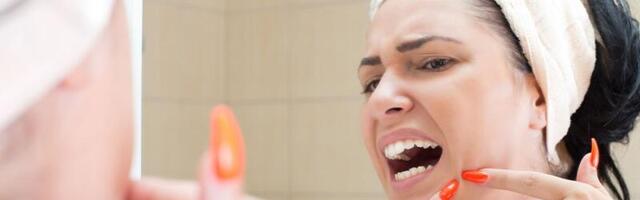 Ära mitte mingil juhul niimoodi punne pigista