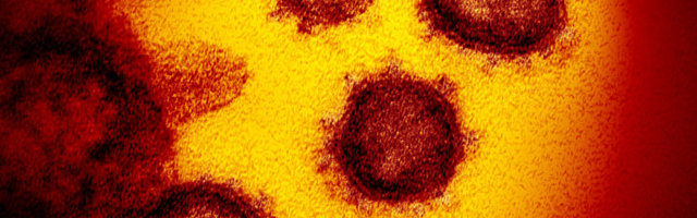 COVID-19 võib kahjustada ka kesknärvisüsteemi