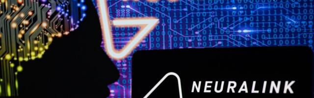 Elon Muski Neuralink implanteeris esimesele inimesele ajukiibi