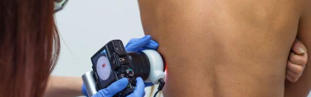 Saksa dermatoloogide ühingu algatuses osaleb Eesti idufirma