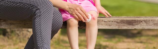 Arstid selgitavad: milliseid traumasid juhtub suvel kõige rohkem ja kuidas nende korral esmaabi anda?