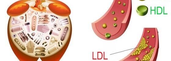 Mul on kõrge kolesterool – ja siis? Apteeker annab nõu.