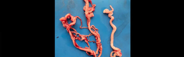 Palsameerijad leiavad endiselt vaktsineeritud inimeste kehadest ebanormaalseid trombe