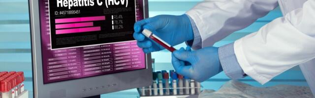 Perearst: C-hepatiit on enamat kui maksahaigus