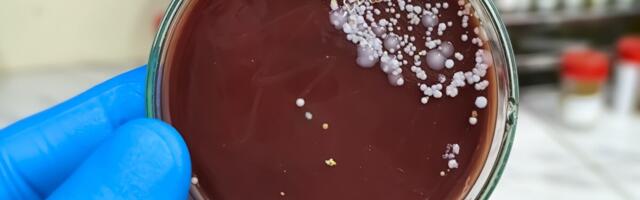 Soomes on maailmas levivat painajalikku pärmseent leitud 11 korral