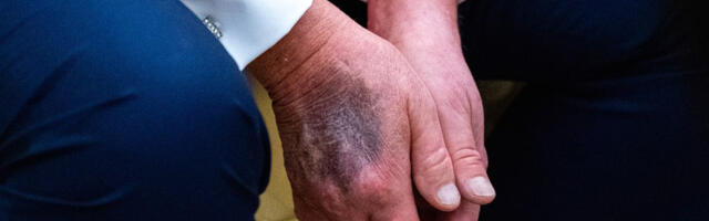 Trump edastas kurjakuulutava sõnumi oma tervise kohta