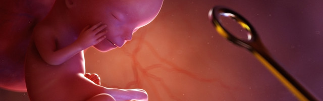 Soomes tahetakse rahvaalgatuse kaudu aborti kättesaadavamaks muuta