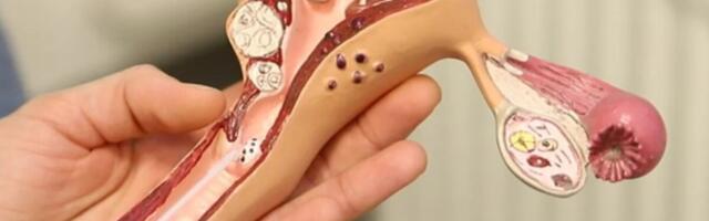 Revolutsiooniline Pap-test võib paljastada neli levinud vähivormi