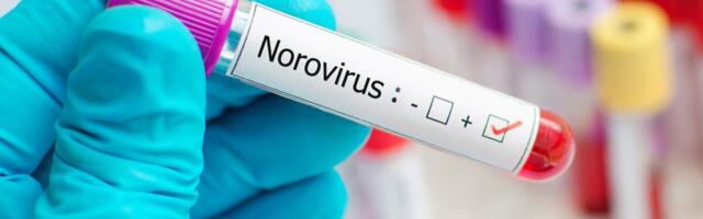 Noroviirust on registreeritud kõvasti rohkem