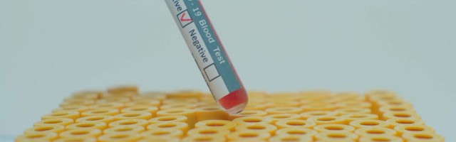 Reporter: Kas Eesti peaks kaaluma Venemaa vaktsiini ostmist?