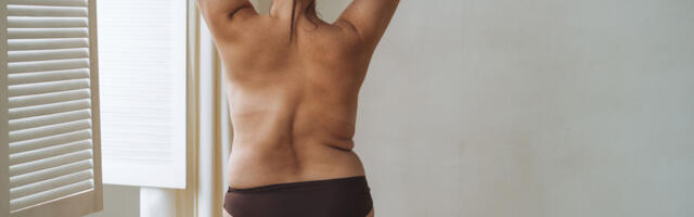 IMEDIEETIDEST VÄSINUTELE võivad abiks olla kaalulangetusravimid