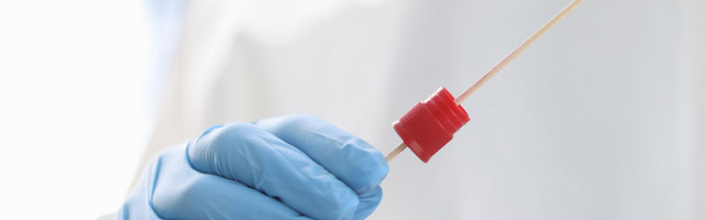 Koroonaviirus Eestis, 25. juuli 2021: ööpäevaga lisandus 90 positiivset