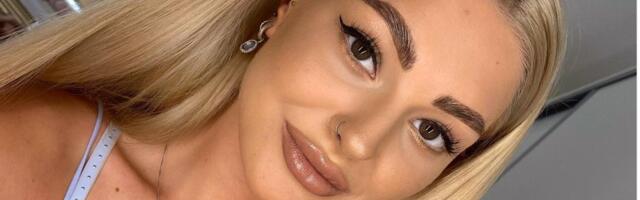 PALJASTAVAD FOTOD: “Rannamaja” Seidi huuled enne ja pärast täitesüste