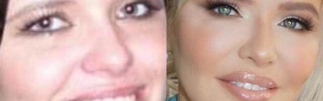 MARJU KARIN paljastas tõe iluoperatsioonil käimise osas