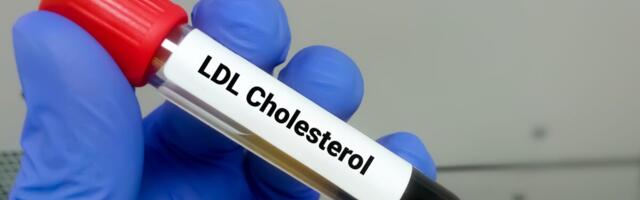 Esmakordselt katsetatud tehnoloogia langetas halva kolesterooli taset