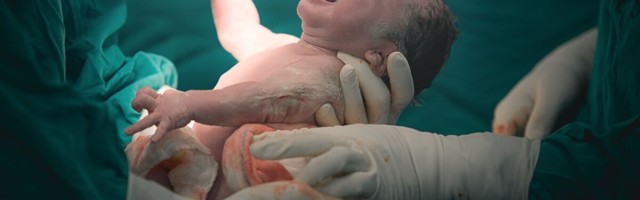 Keisrilõike järgselt esineb kroonilist valu kuni pooltel emadel