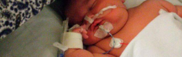 Ühendkuningriigis sündis rekordsuuruses beebi