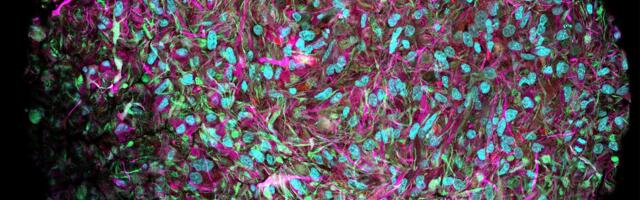 Ajakirjanikud külastasid Šveitsi laborit, kus tehakse inimajudest arvuteid