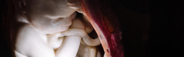 Ohtlik tervisenõu suunamudijate poolt langeb sõnavabaduse kaitse alla