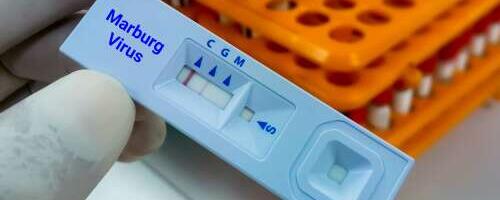 Mis haigus on Marburgi viirus?