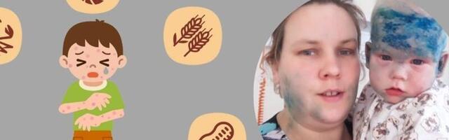 Tee keerulise diagnoosini: Poiss oli üle keha erkpunaseid laike täis, nahk ketendas, karetas ja sügeles, laps oli ülirahutu