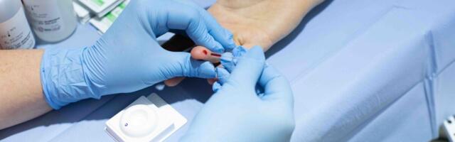 Eestis on tänavu kümne kuuga HIV diagnoositud 161 inimesel