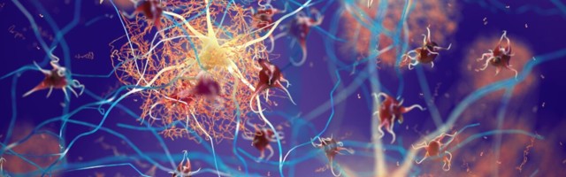 Eisai ja Biogen alustavad USA kiirendatud heakskiitu taotlemist uuele Alzheimeri tõve ravimile