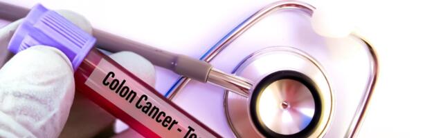 Doktor Seire: Eesti jämesoolevähi sõeluuringu vanuselävi on liiga kõrge