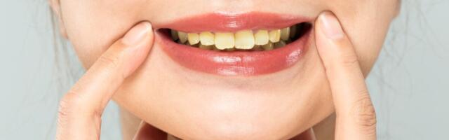 Soome hambaarst hoiatab nikotiinipatjade ja e-sigarettide eest