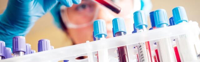 USA uurib seoseid laste nohuviiruse ja ägeda hepatiidi vahel