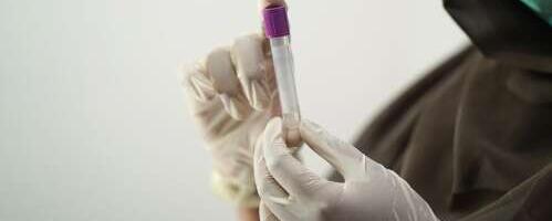 Mis haigus on Langya henipavirus?