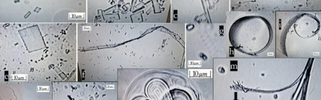Uuring kinnitab, et mRNA Covidi süstides leidub isemoodustuvaid nanoosakesi