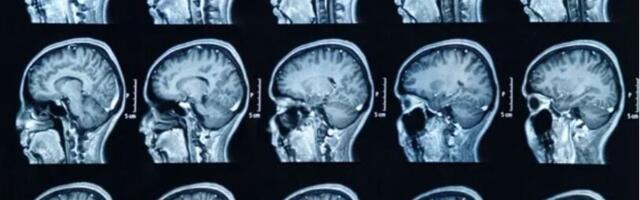 Uus aju kasutajaliides suudab mõtted sõnadeks tõlkida