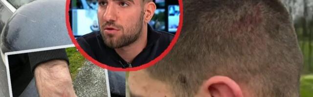 KRVNIČKI PRETUČEN VUKAŠIN ĐOKOVIĆ! Divljaci razbili auto aktivisti SNS u Smederevskoj Palanci, pa ga brutalno prebili! (FOTO, VIDEO)