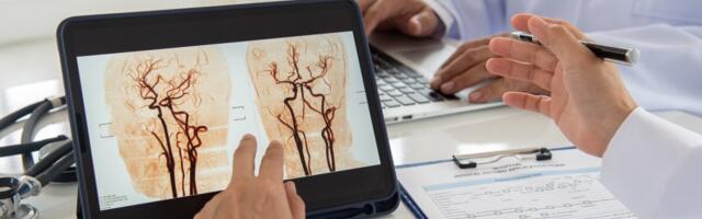 Riia haigla kasutab tehisintellekti insuldi kiireks diagnoosimiseks