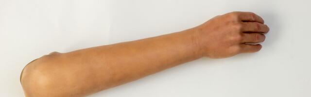 Mees kandis vaktsineerimise võltsimiseks käeproteesi