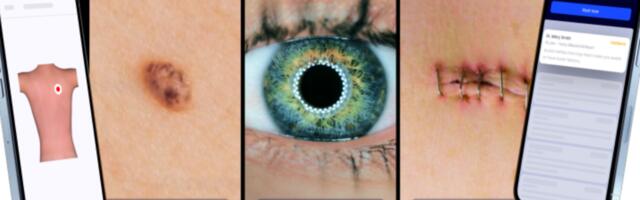 Digilahendus tõi uued võimalused: silmaarstid saavad silmahaigusi diagnoosida ja ravida senisest paremini
