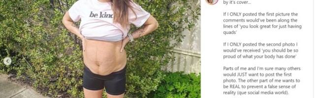 FOTOD | Nelikute ema näitab, milline näeb tema keha välja peale sünnitust ja tal on oluline sõnum kõikidele naistele