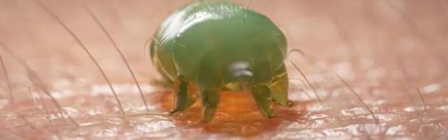 Soomes on tänavu registreeritud rekordiliselt sügelisi