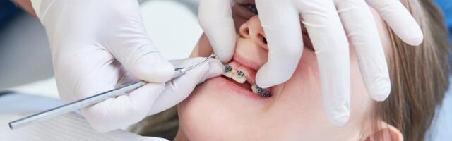 Lapse iga puseriti hammas ei vaja ortodondi abi