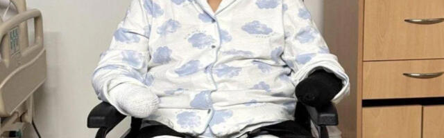 Hoiatav juhtum: naine kaotas kõik oma jäsemed pärast seda, kui lasi neid koeral lakkuda