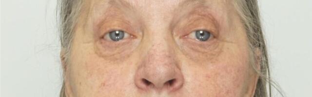 LEITUD!Politsei otsib Tallinnas kadunud 77-aastast Zojat