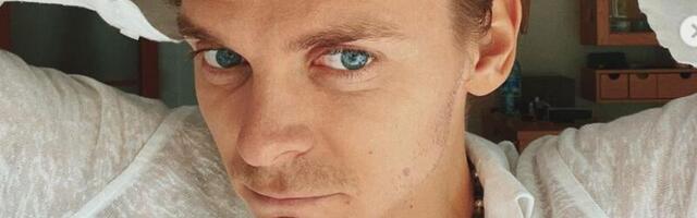 ENNE JA PÄRAST FOTOD: KATRI KATSI mees käis Türgi ilukliinikus välimust tuunimas