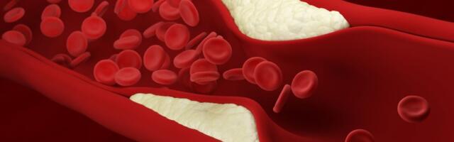 Uuring: muidu tervetel noortel leiti arterite kõvenemist