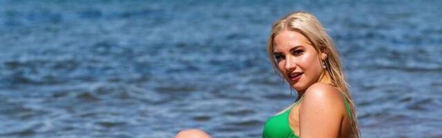 PALJASTAVAD FOTOD: “Rannamaja” Brita huuled enne ja pärast iluprotseduuri