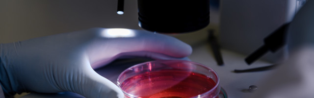 Valitsus eraldas täna koroonaviiruse leviku seireks veel 880 000 eurot